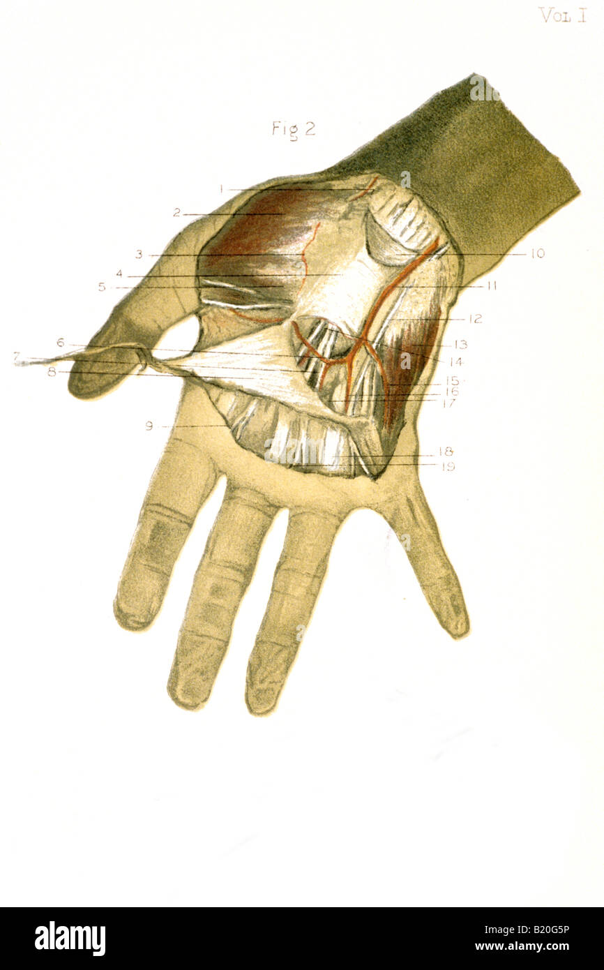 Immagine che mostra la dissezione di arteria a mano i nervi tendini Foto Stock