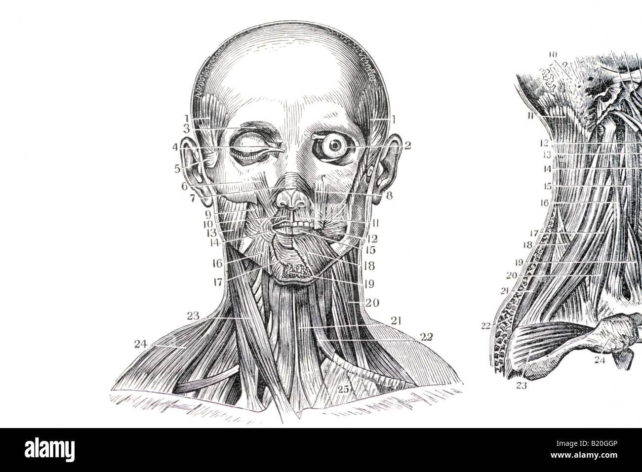 Illustrazione dei muscoli del viso e del collo Foto Stock