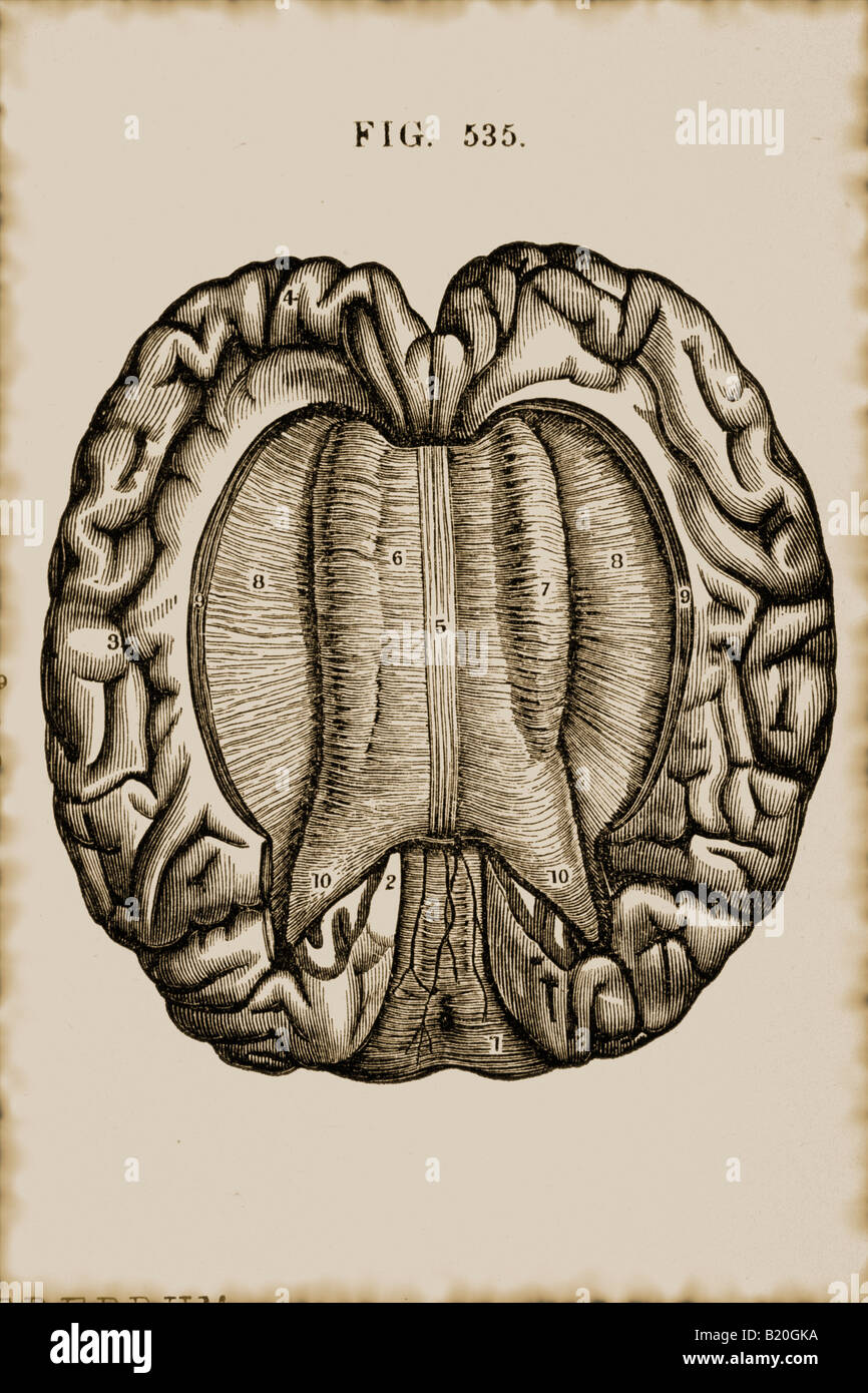 Immagine che mostra il corpo calloso del cervello Foto Stock