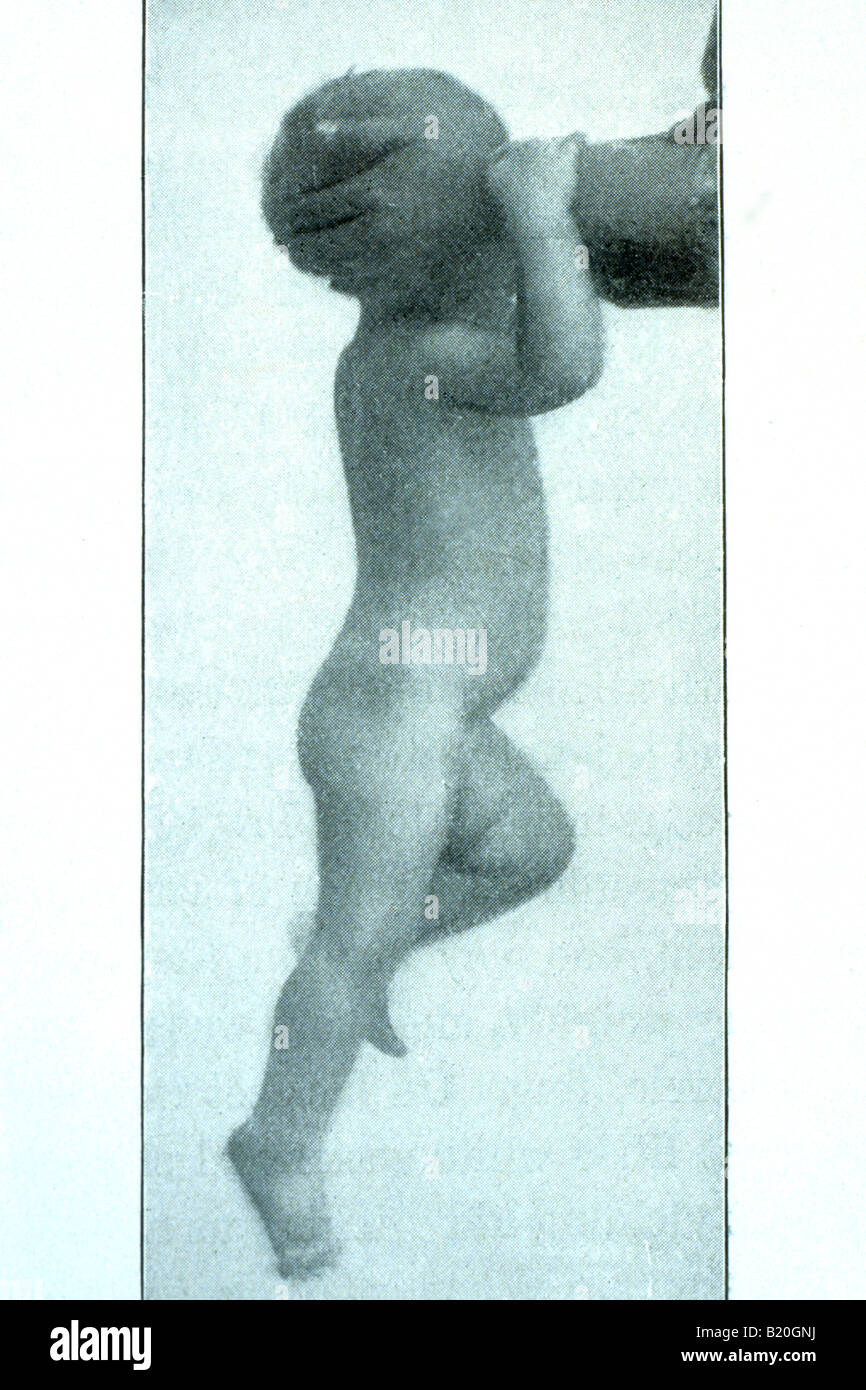 Foto storiche del bambino di sollevamento dal retro del collo Foto Stock