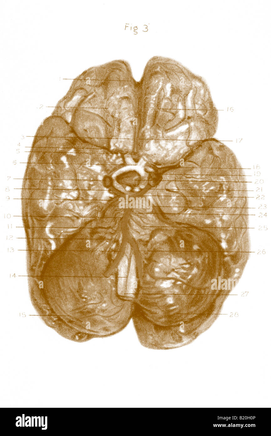 Immagine base delle arterie cerebrali circolo di Willis Foto Stock