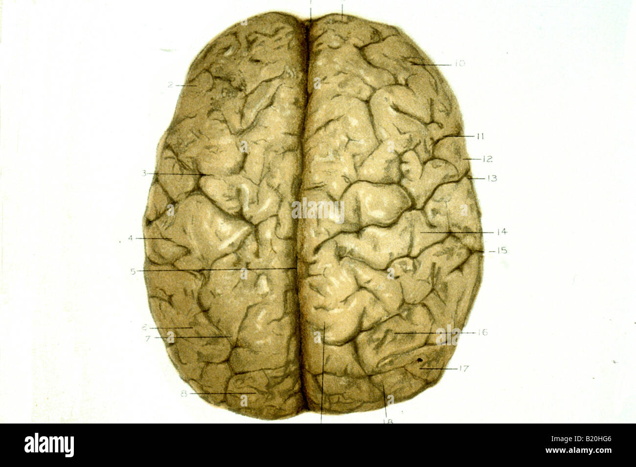 Immagine che mostra la superficie superiore cervello umano normale Foto Stock