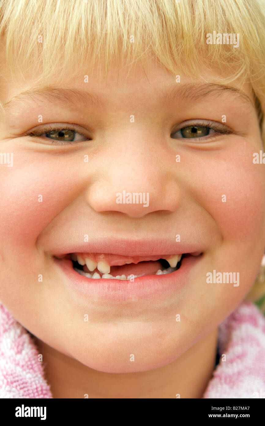 6 anno vecchia ragazza che mostra i suoi denti mancanti. Foto Stock