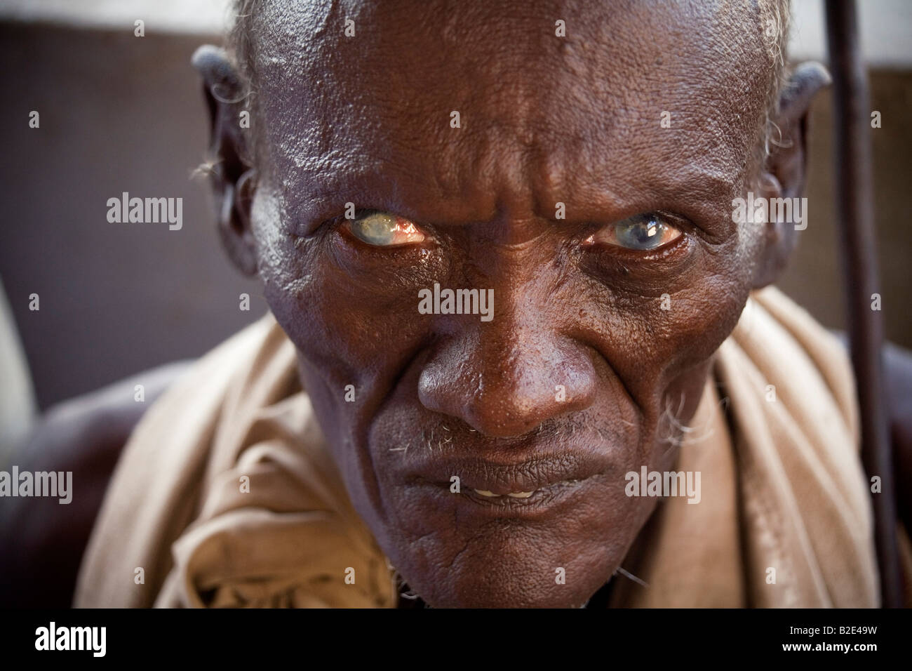 Un uomo che soffre degli effetti del tracoma attende al di fuori di un governo rurale clinica sanitaria nella regione di Afar in Etiopia. Foto Stock