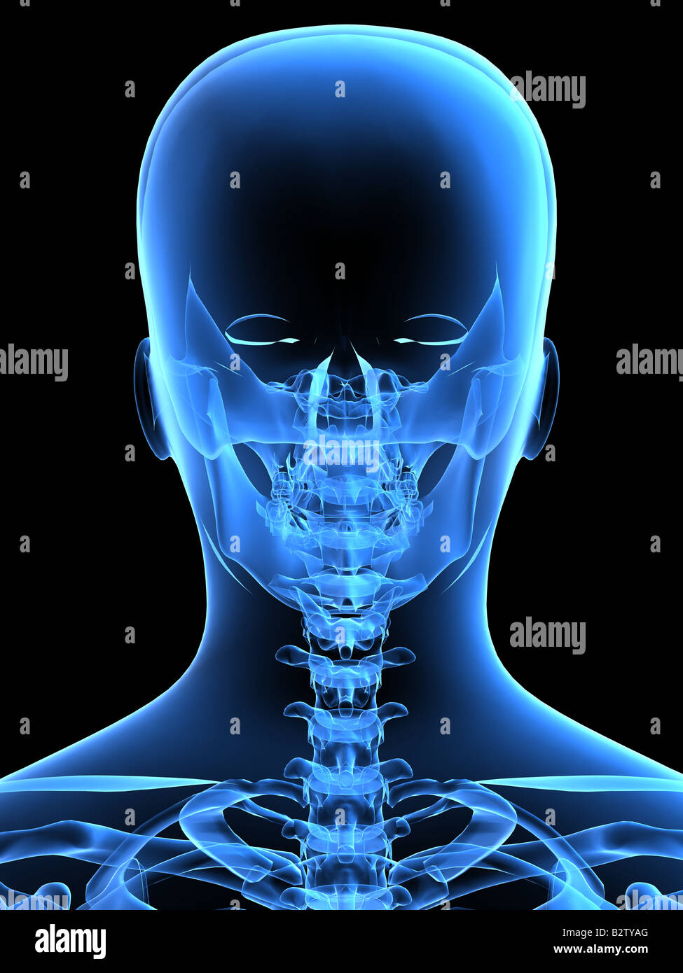 testa del radiografico Foto Stock