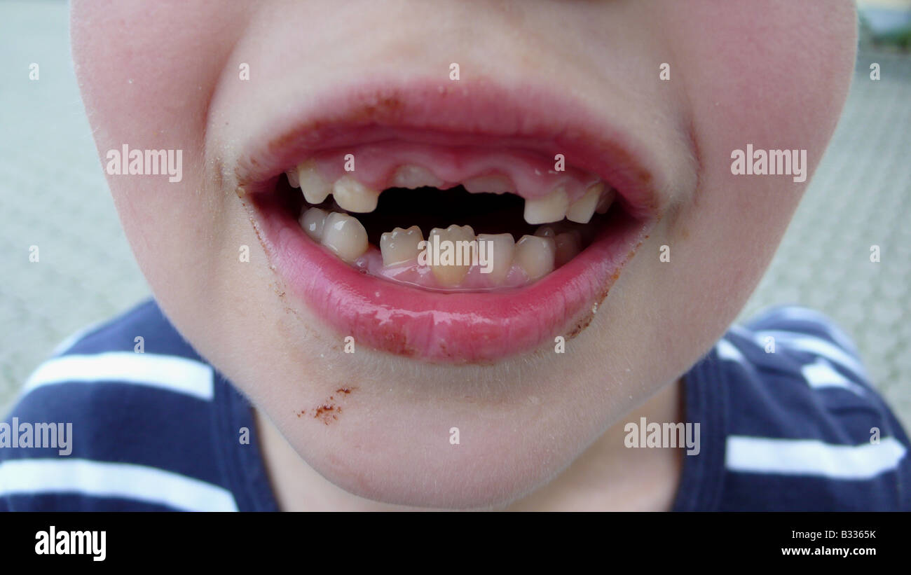 Bambino con dente divario Foto Stock