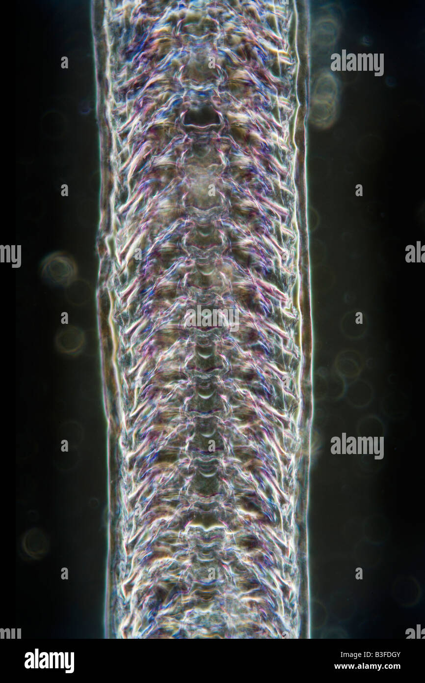 Lumaca darkfield radula microfotografia che mostra la superficie raspatura Foto Stock