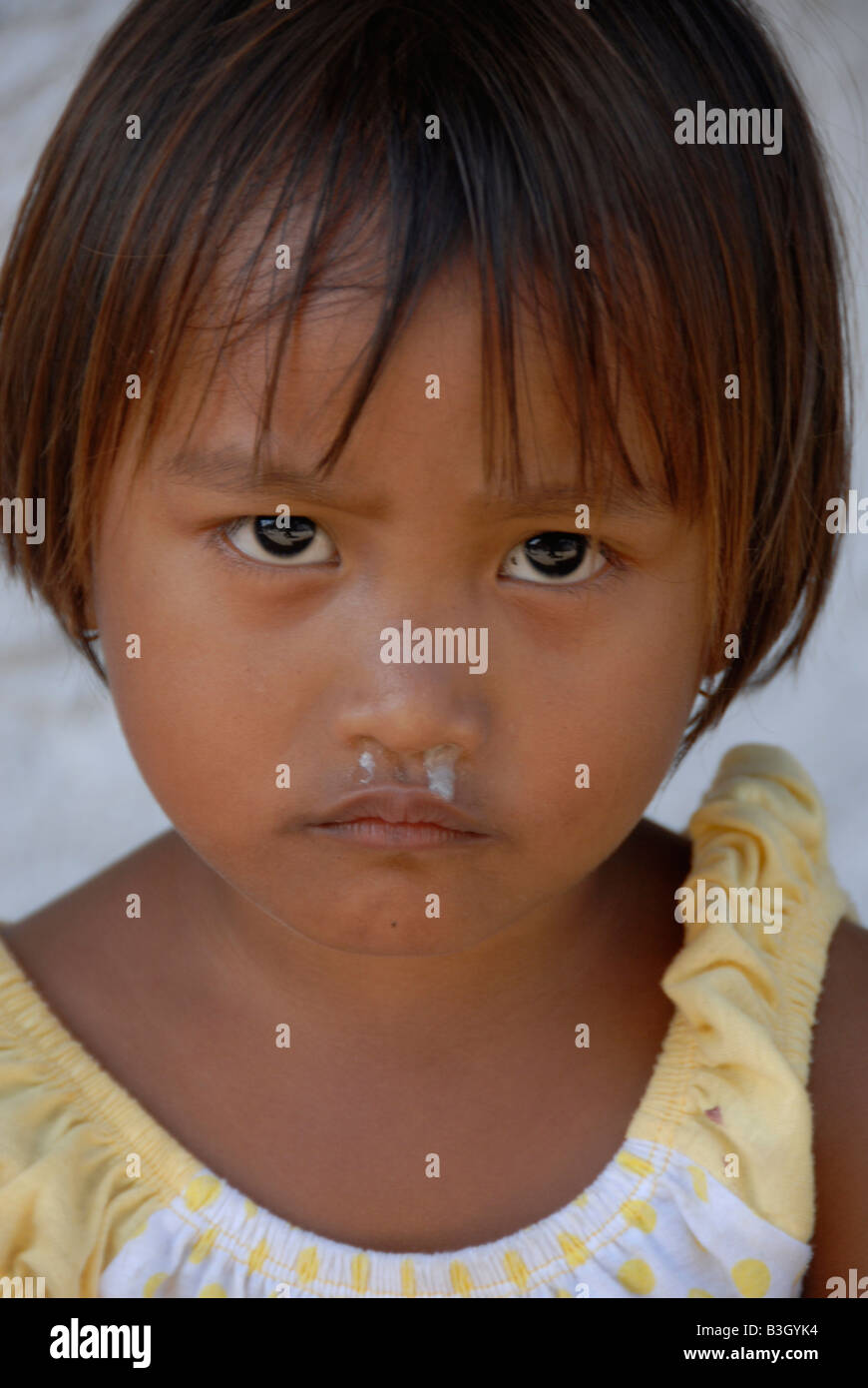 Ragazza povera nella baraccopoli di kuta , kuta , bali , Indonesia Foto Stock