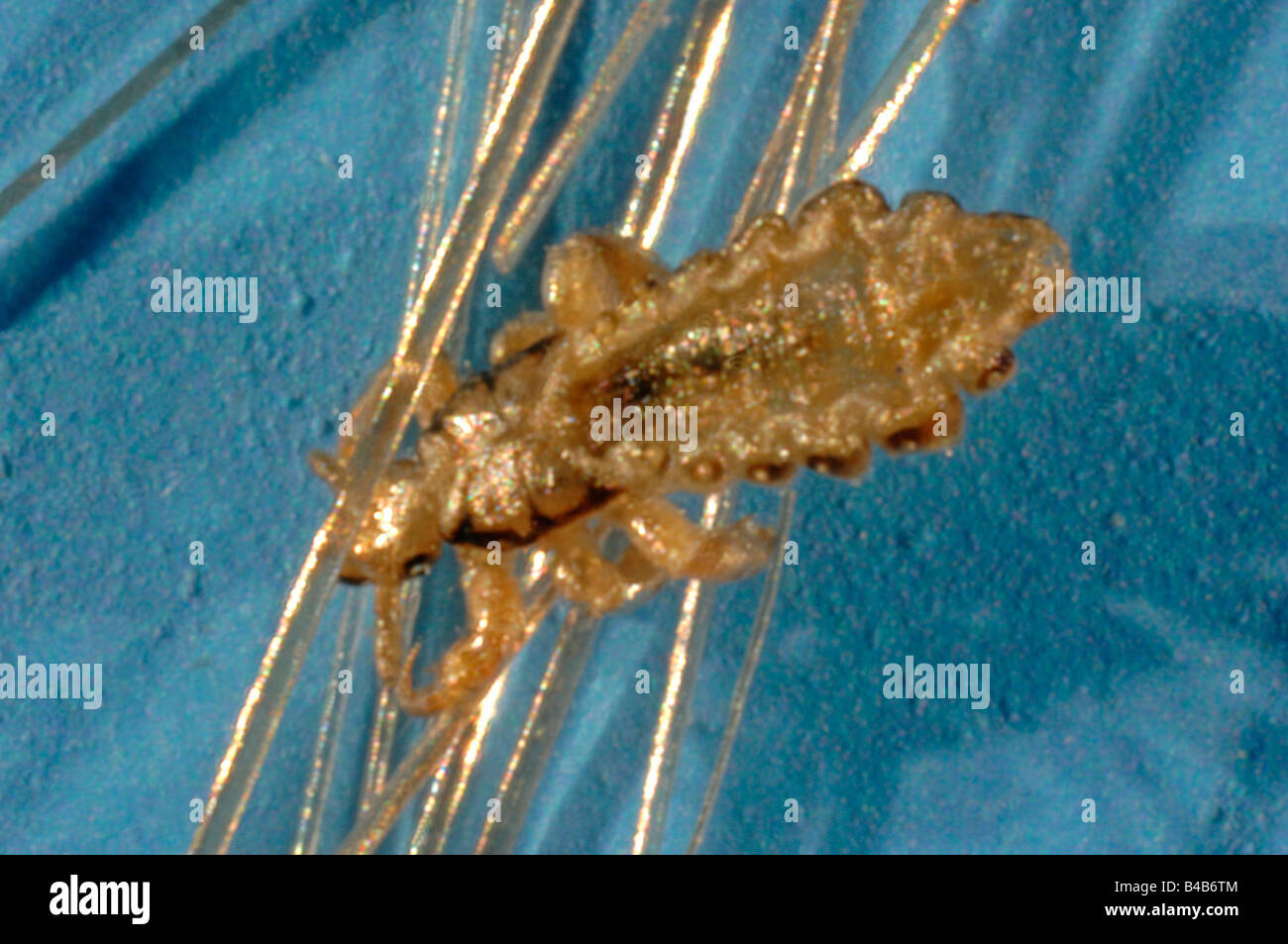 Testa (pidocchio Pediculus humanus capitis) sui capelli umani Foto Stock