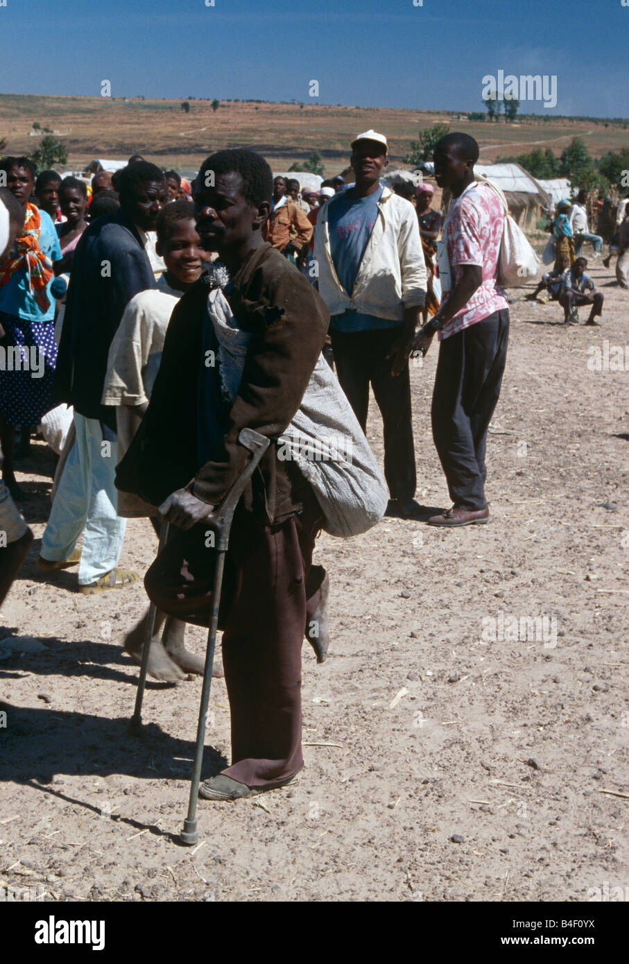 Una vittima della guerra civile in un campo per sfollati in Angola. Foto Stock