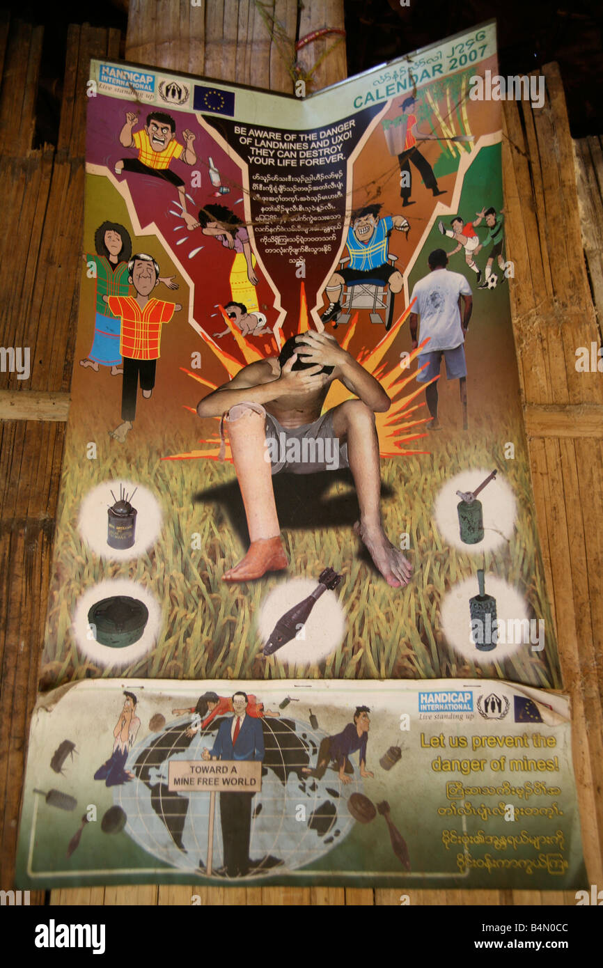 Un poster avviso di persone circa i pericoli causati dalle mine antiuomo questo poster appeso in un campo di rifugiati dove i profughi birmani sono ora vivere in Thailandia per sfuggire alla persecuzione di circa 300 di loro sono membri del gruppo indigeno noto come Longnecks il più grande dei tre villaggi dove la Longnecks live è chiamato Nai Soi situato vicino a Mae Hong Son City Longnecks usura degli anelli di metallo sul loro collo che spingono la clavicola fatto ed estendere il collo Foto Stock