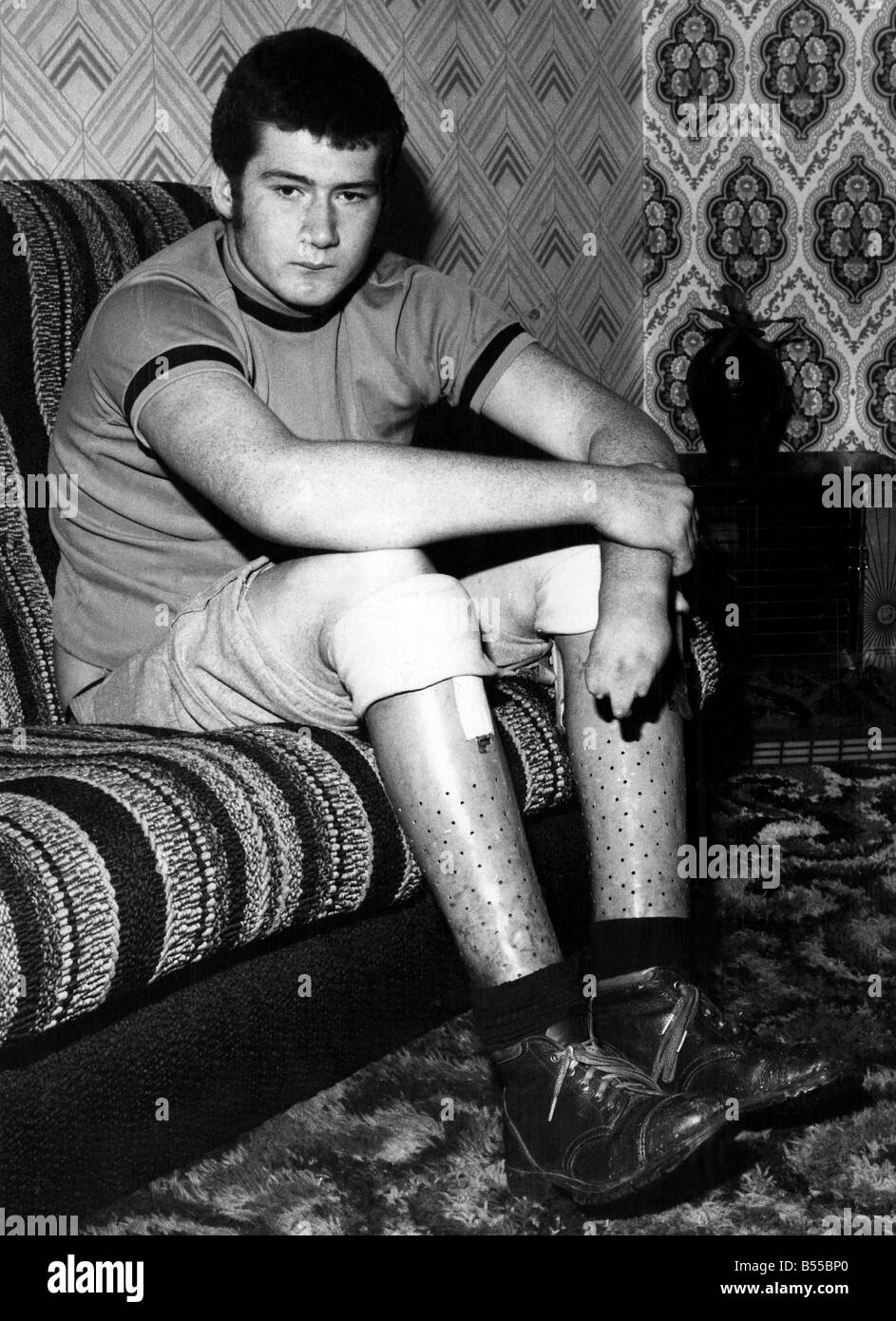 Medical - Talidomide: ancora in attesa. Brian Huckstepp. Egli era due volte dichiarato di talidomide bambino da un chirurgo che ha scritto che egli aveva N Foto Stock