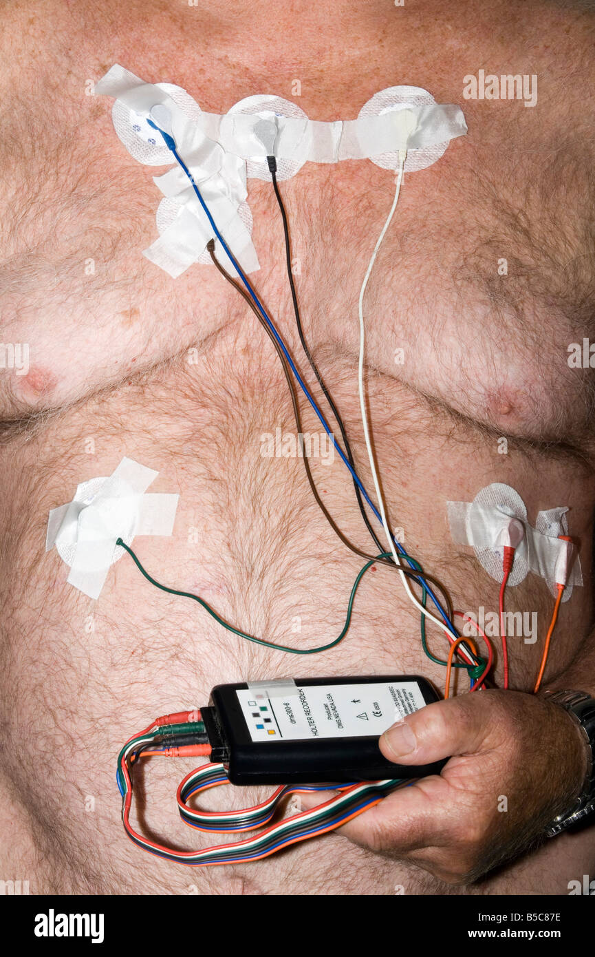 Paziente che indossa una 24 Ore di registratore Holter monitor questo è utilizzato per la registrazione continua di un ECG di pazienti o ritmi cardiaci. Modello rilasciato Foto Stock