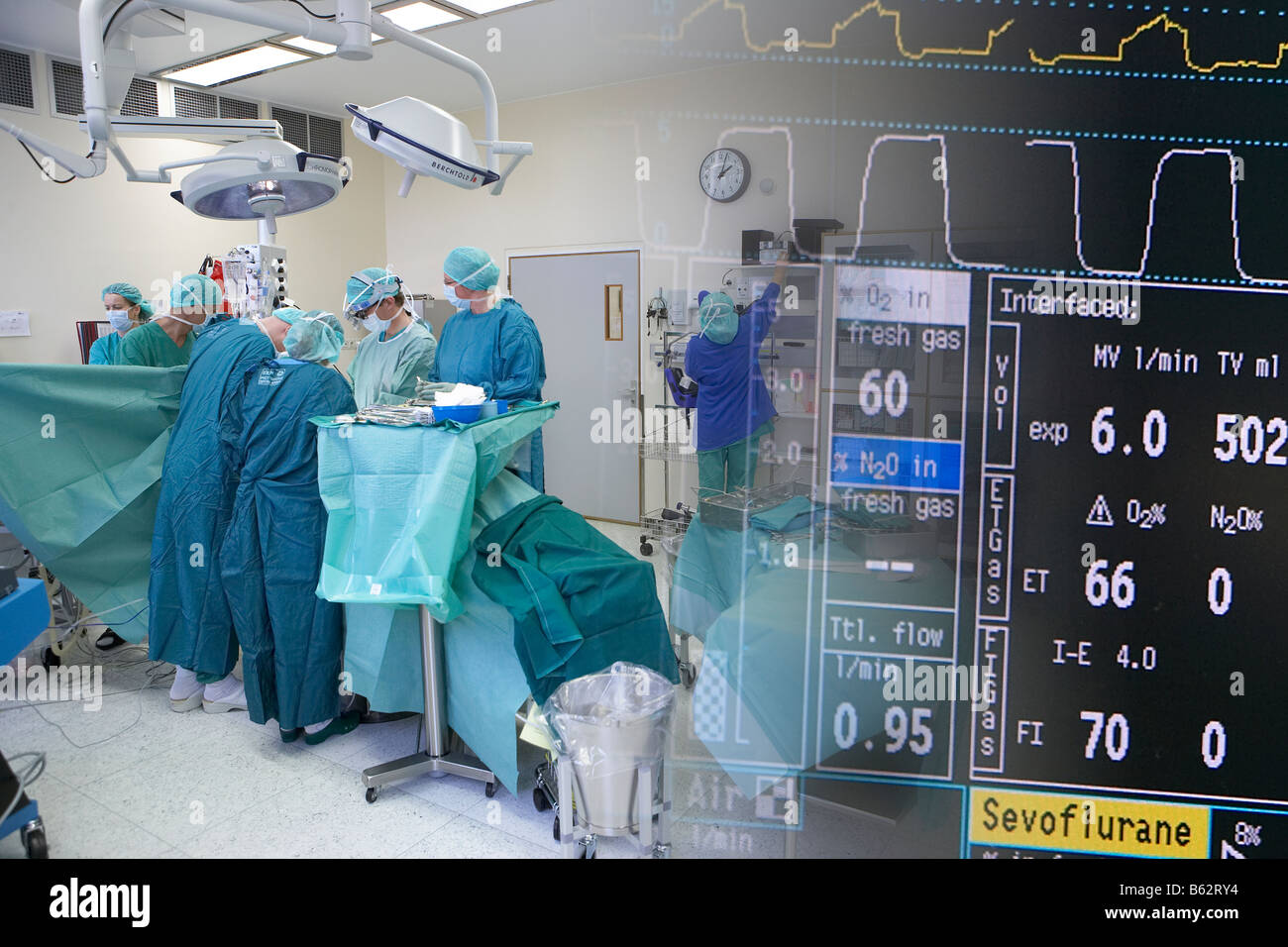 Il team chirurgico di eseguire cuore chirurgia di bypass, Reykjavik, Islanda Foto Stock