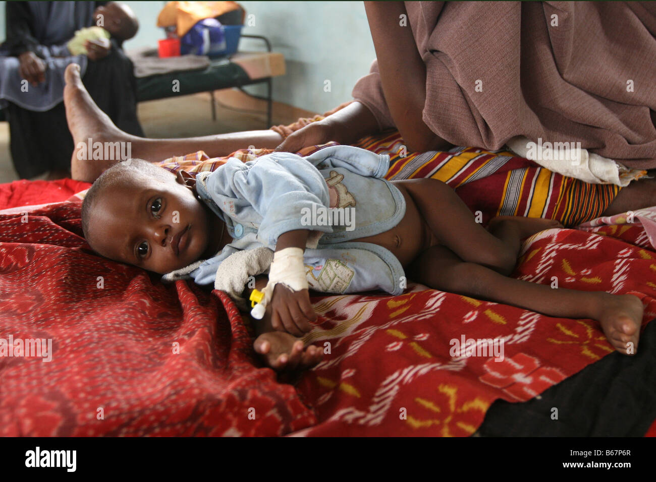 I denutriti dei rifugiati somali ragazzo in un ospedale nel campo di rifugiati di Dadaab, al confine della Somalia e Kenya Foto Stock