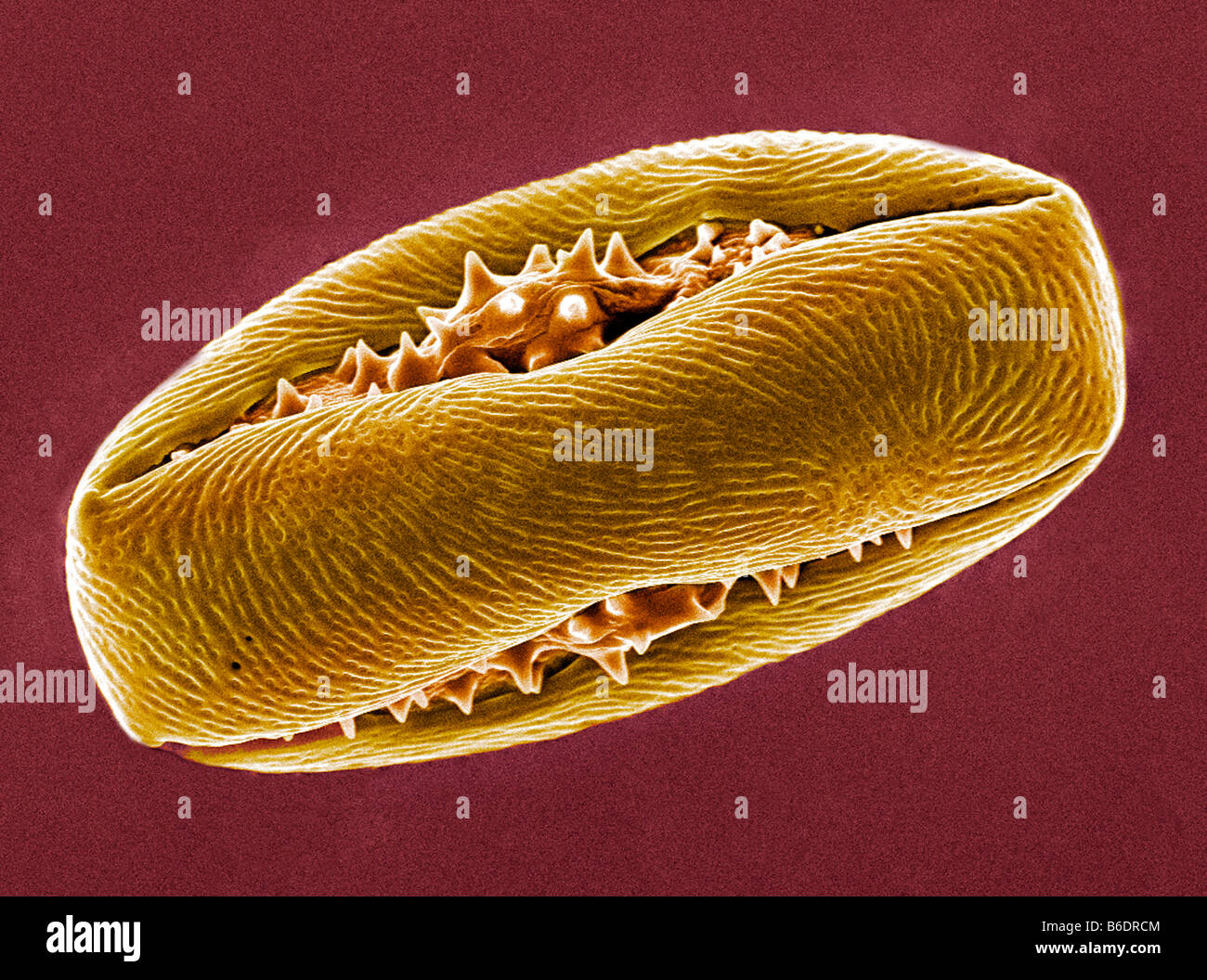 Ippocastano granello di polline. Colorate micrografia scanningelectron (SEM) di un granello di polline da un cavallo di fioritura di castagno. Foto Stock