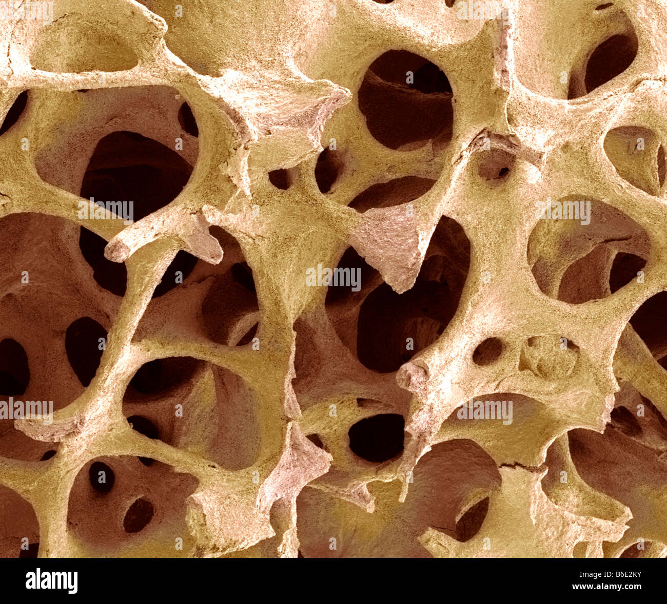 Il tessuto osseo. Color scanning electron microfotografia (SEM) di spugnoso spugnoso (osso). Foto Stock