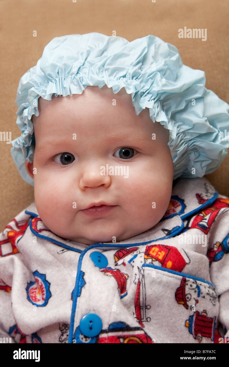 Baby, di età di 5 mesi, indossando un coperchio della testata seguendo il suo trattamento per culla cappuccio, una condizione del cuoio capelluto. Foto Stock