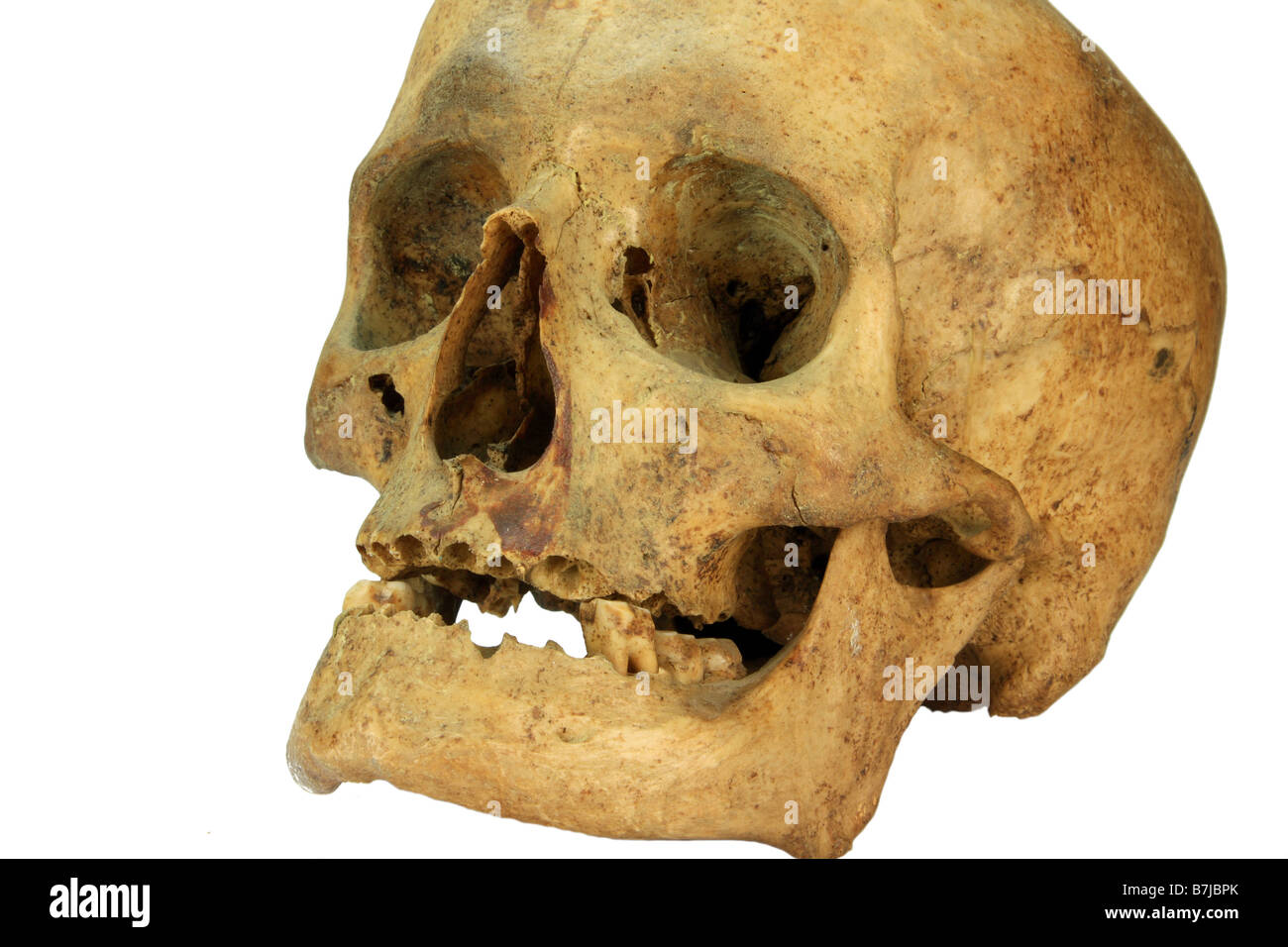 Un cranio di una persona di sesso femminile isolato su bianco Foto Stock