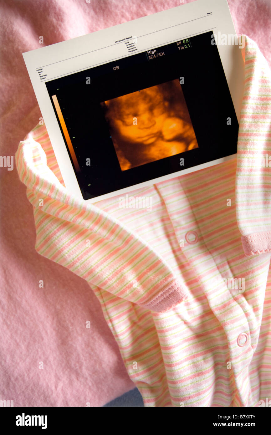 Tridimensionali foto a ultrasuoni Foto Stock
