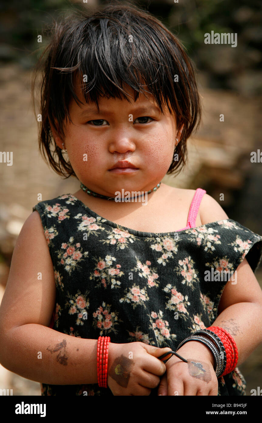Annapurna Nepal 18 marzo 2008 gurung giovane ragazza con molto secco guancia pelle dovuta al freddo clima di montagna Foto Stock