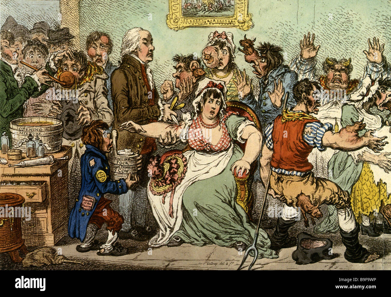 Il vaiolo - Edward Jenner facendo le vaccinazioni - vedere la descrizione riportata di seguito Foto Stock