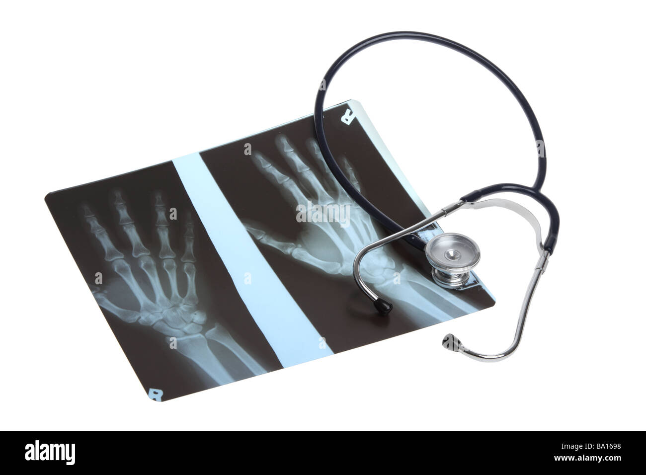 I raggi x e uno stetoscopio intaglio su sfondo bianco Foto Stock