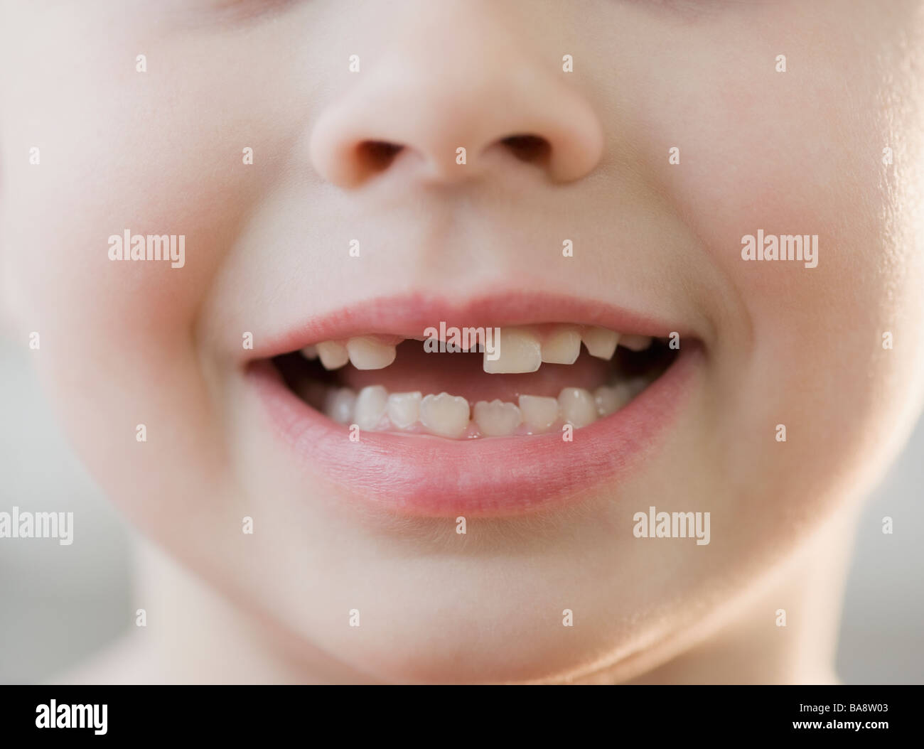 Ritratto di ragazzo con denti mancanti Foto Stock