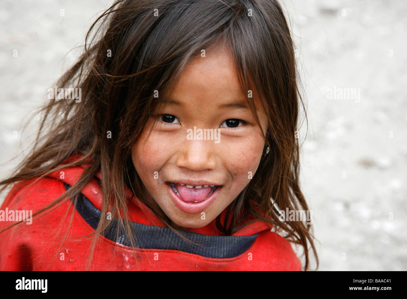 Annapurnas Nepal 30 marzo 2008 Giovane ragazza nepalese con luce ciocche di capelli che è una prova di malnutrizione Foto Stock
