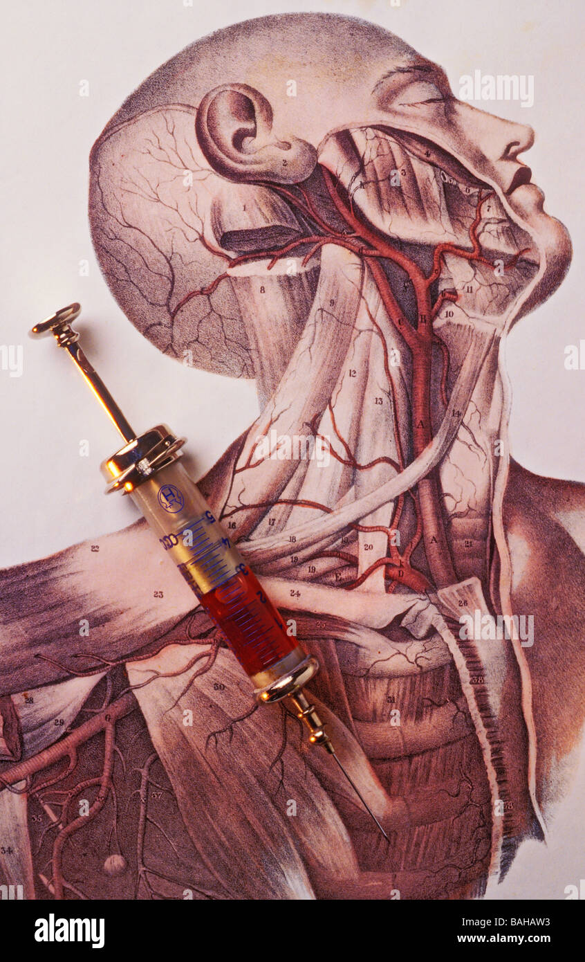 Vecchia Illustrazione medica e la siringa Foto Stock