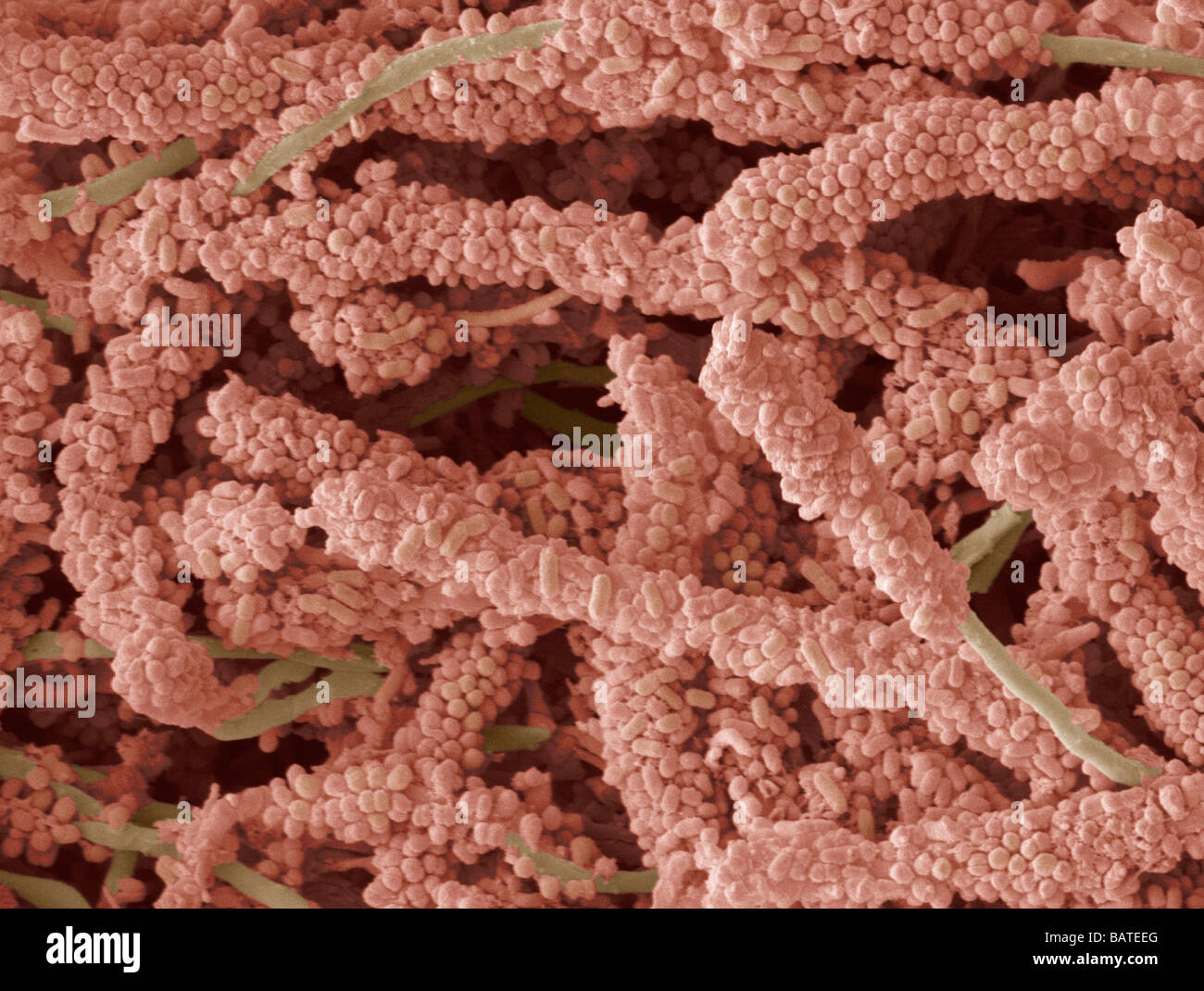 La placca-la formazione di batteri, colorati micrografia  scanningelectron(SEM). La placca dentale è un biofilm di batteri che si  forma sui denti Foto stock - Alamy