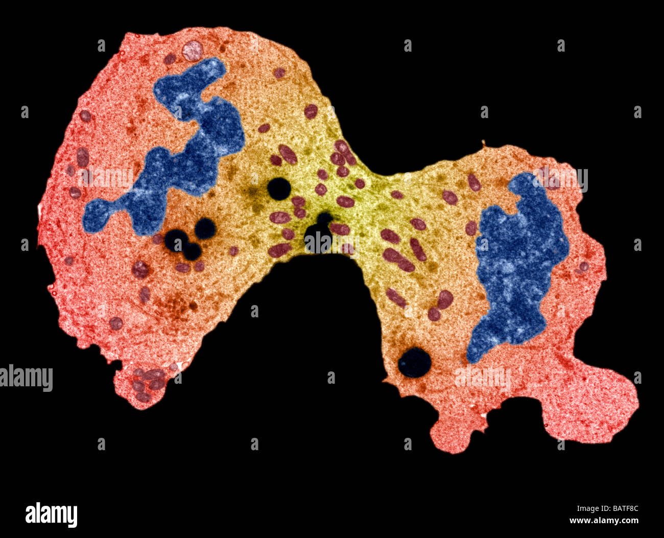 Divisione delle cellule tumorali. Colorate micrografia transmissionelectron (TEM) di una sezione attraverso una cellula di cancro. Foto Stock