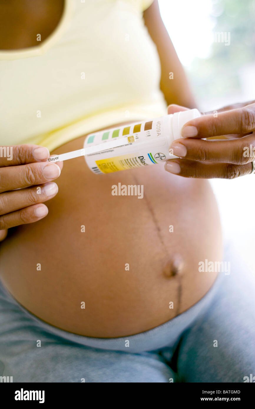 Il test del glucosio durante la gravidanza. Donna incinta controllo del  colore di una striscia di reagente utilizzato in un Clinistix test delle  urine Foto stock - Alamy