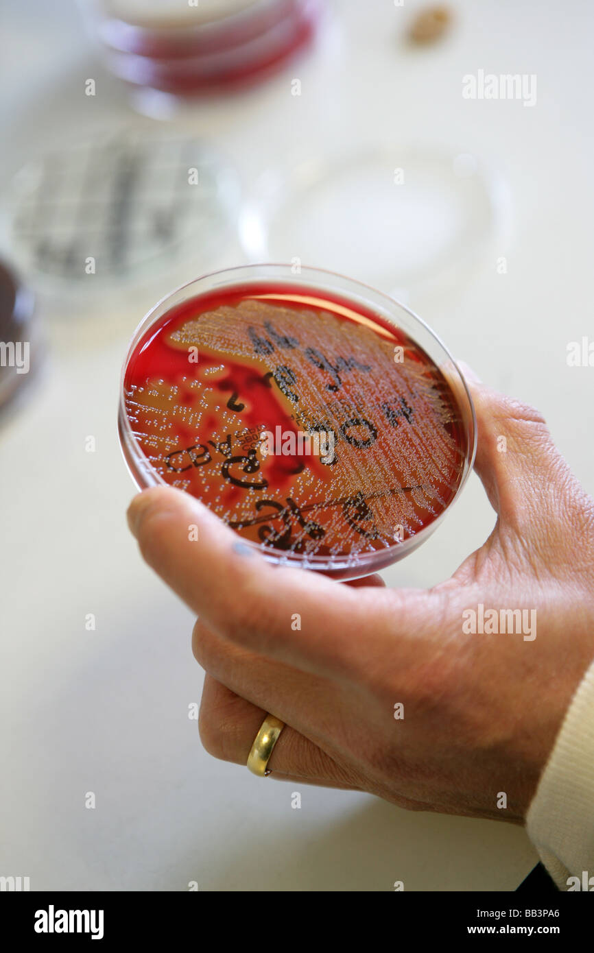 I batteri nocivi essendo cresciuto alla ferita di prova tamponi presi da un paziente Foto Stock