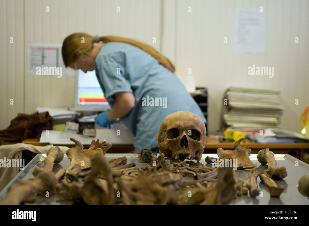 Archeologo forense che esamina un cranio umano presso la struttura mortuaria della commissione ICMP di persone scomparse dalla guerra bosniaca a Lukavac, Bosnia Foto Stock