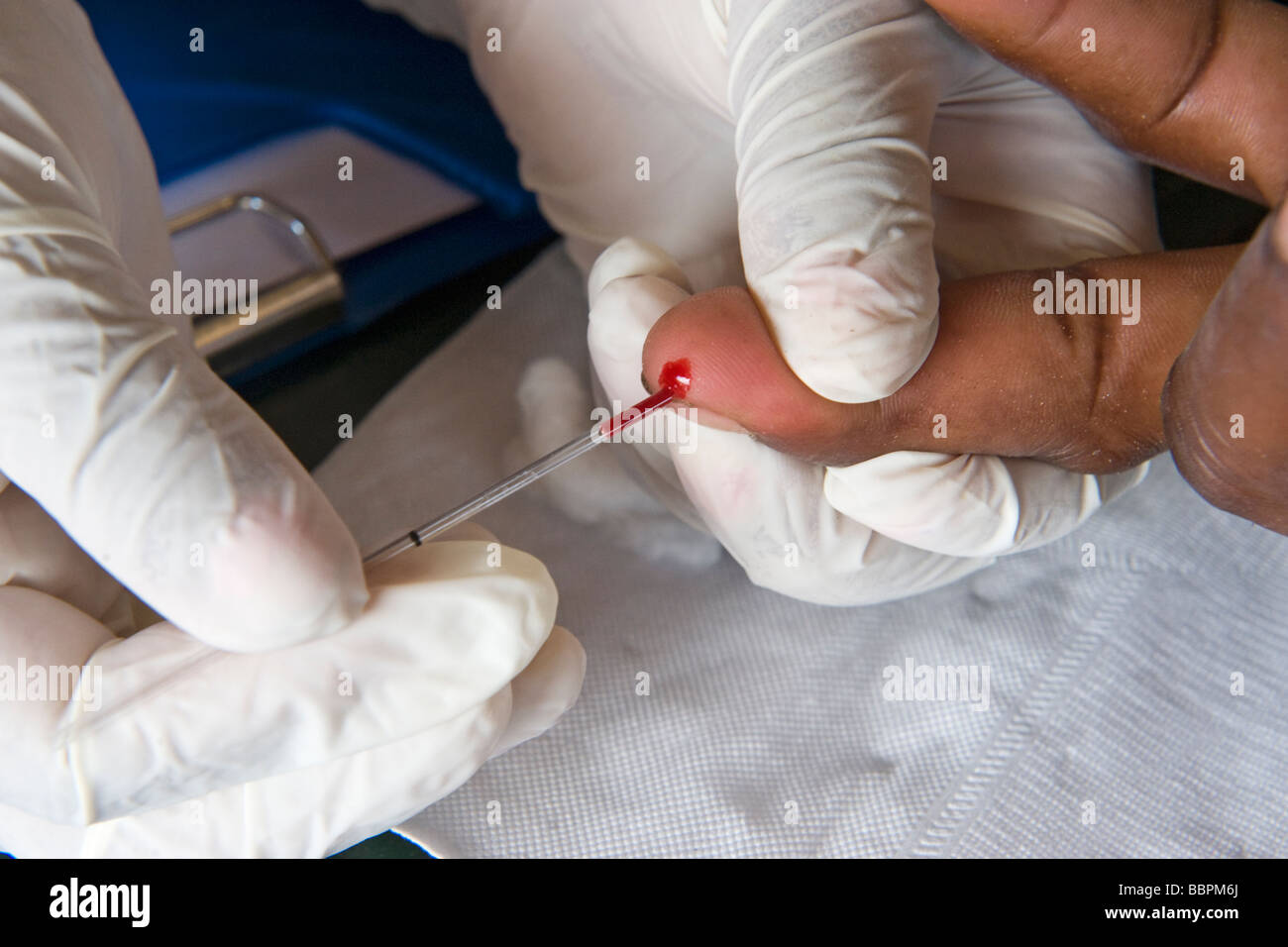 Prendere un campione di sangue per il test rapido HIV Quelimane Mozambico Foto Stock