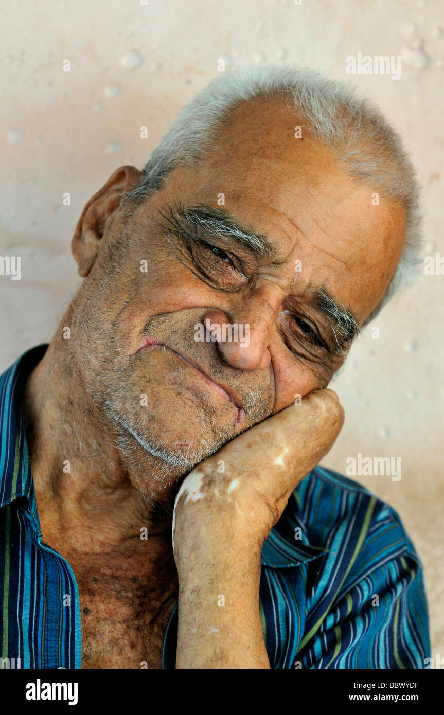 La lebbra paziente, 78 anni, con una mano paralizzata, triste sorriso, lebbra colony Agua de Dios, Colombia, Sud America Foto Stock