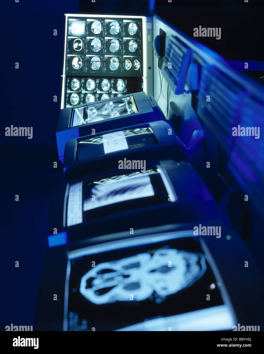 Contemporanea immagini Xray scansioni cerebrali Foto Stock