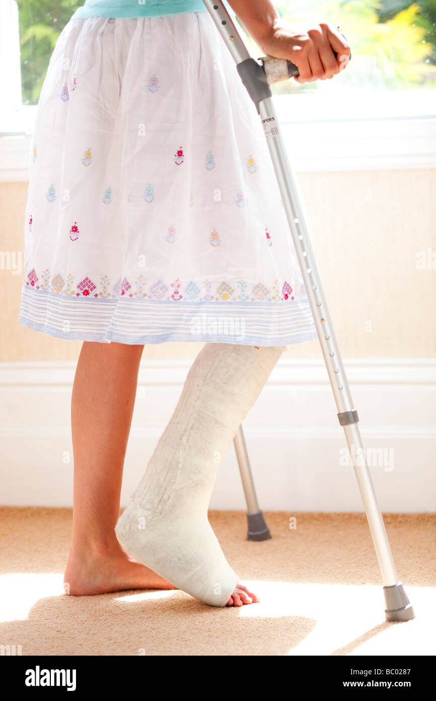 Donna con la gamba rotta Foto Stock