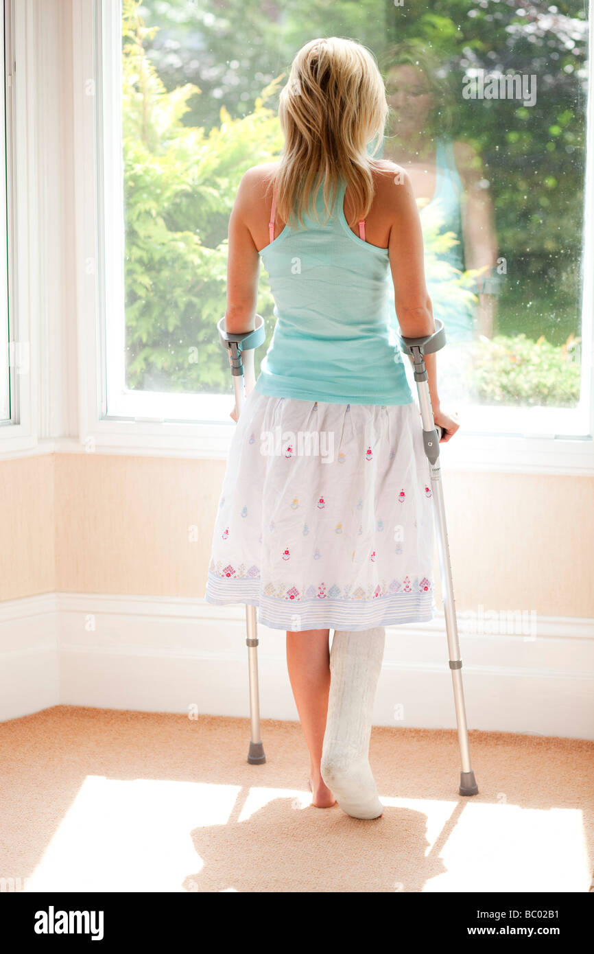 Donna con la gamba rotta Foto Stock