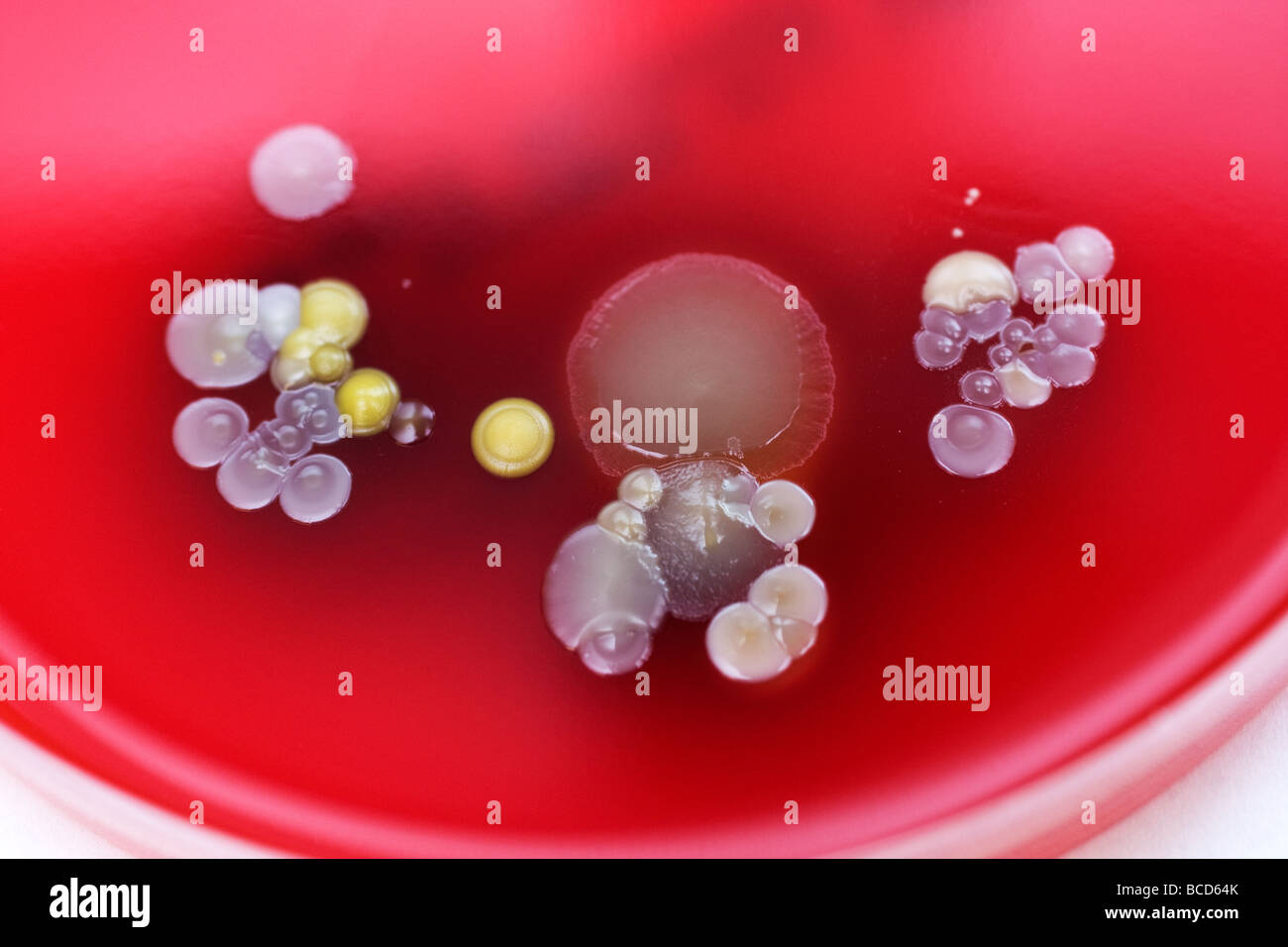 Piastre di Petri contenenti le colonie di Staphylococcus epidermidis & Diptheroids Foto Stock