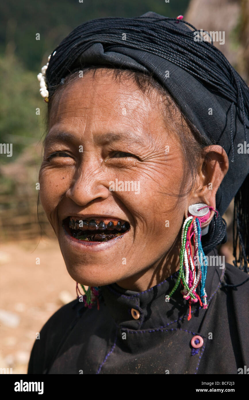 Myanmar Birmania, Pan-lo. Una donna della piccola tribù di Ann in abito tradizionale con denti annerito. Per allontanare gli spiriti maligni. Foto Stock