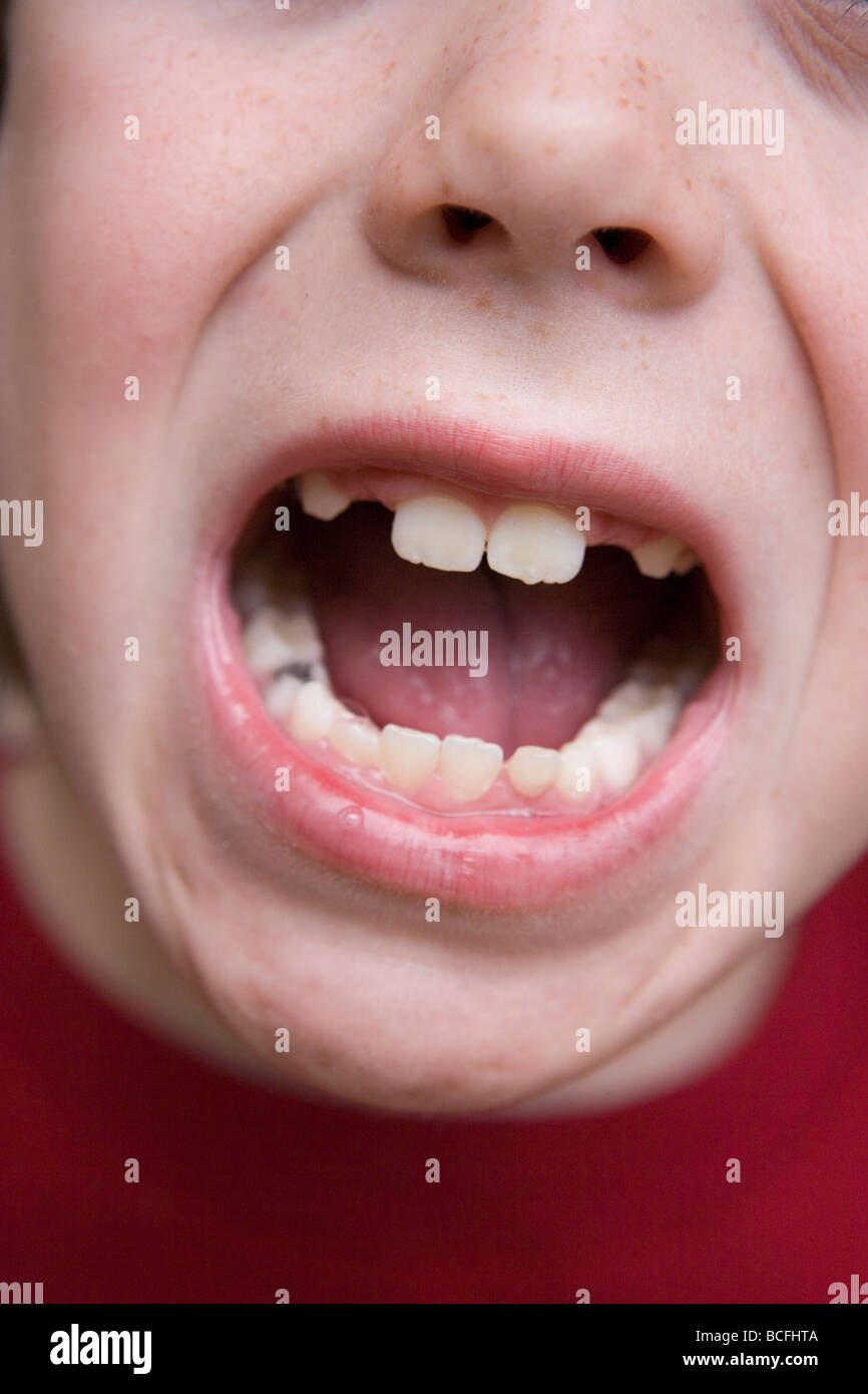 Chiusura del bambino di 7 anni la bocca con denti mancanti Foto Stock