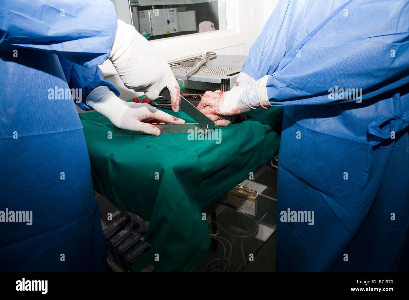 La contornazione ortopedico la piastra ossea Foto Stock