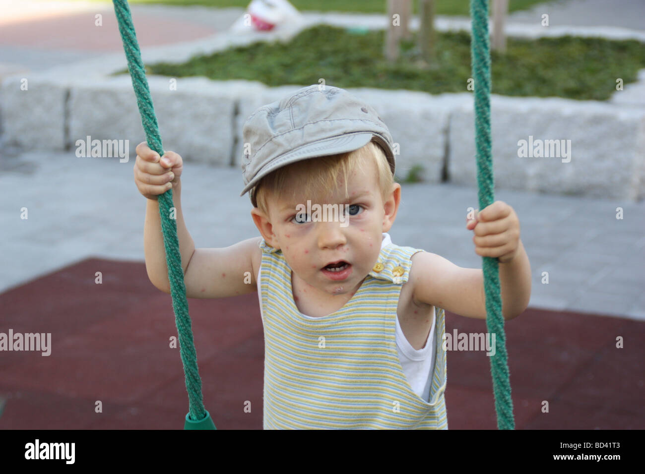 2-anno-vecchio ragazzo con la varicella tuttavia godendo il parco giochi. Foto Stock