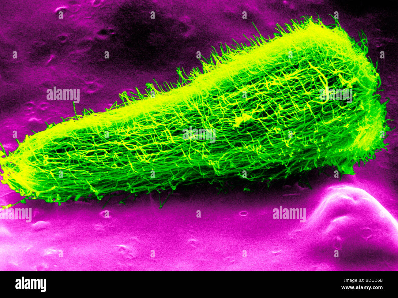 Fegato di pecora FLUKE LARVA Foto Stock