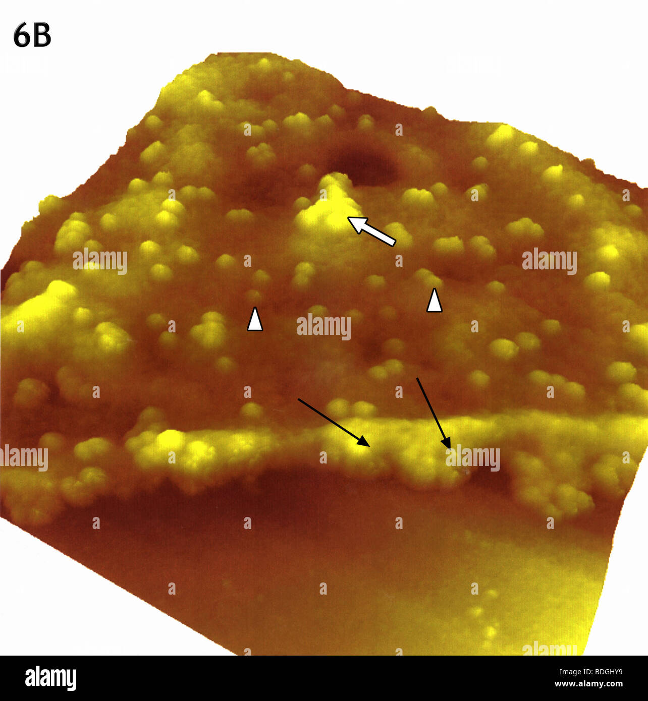 CORONAVIRUS Foto Stock
