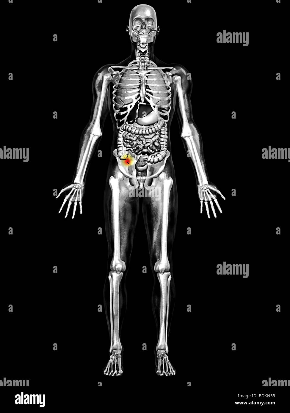 Umano illustrazione anatomica di un uomo adulto che mostra i polmoni e il sistema digestivo con la appendice evidenziata Foto Stock