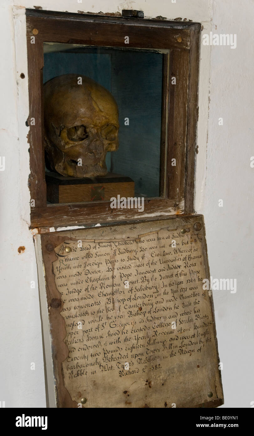 Il cranio di Simon di Sudbury, la chiesa di Saint Gregory, Sudbury, Suffolk. Foto Stock