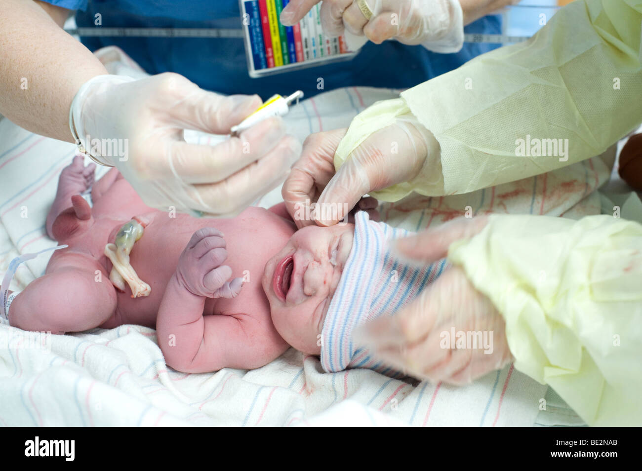 Neonato bambino ispanica è dato il trattamento profilattico di gocce per gli occhi immediatamente dopo la nascita per prevenire le infezioni. Il bambino è il modello rilasciato. Foto Stock